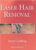 Laser Hair Removal (Series in Cosmetic and Laser Therapy) Reviews